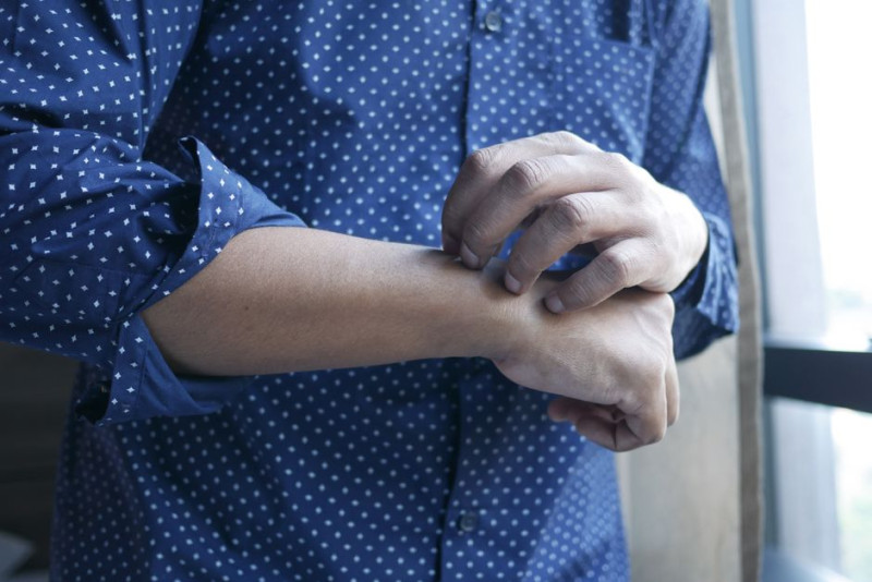 Could Itchy Spots on My Wrist Be Shingles After Shingrix?